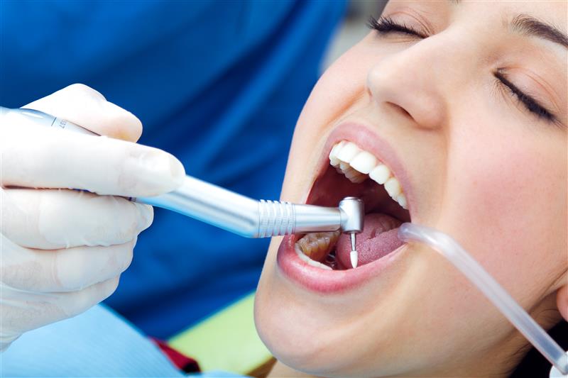 Teeth Cleaning at Beverly Hills