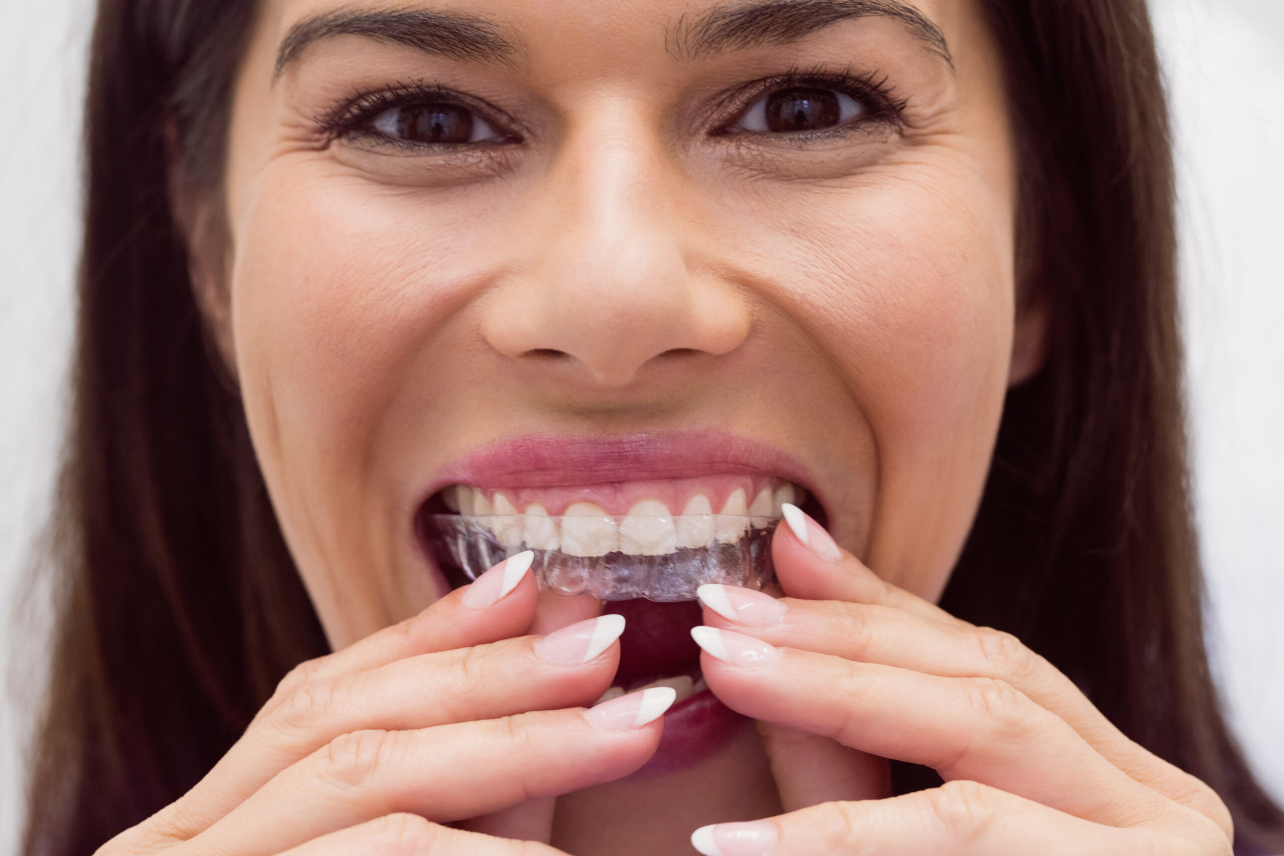 Female patient wearing braces in dental clinic