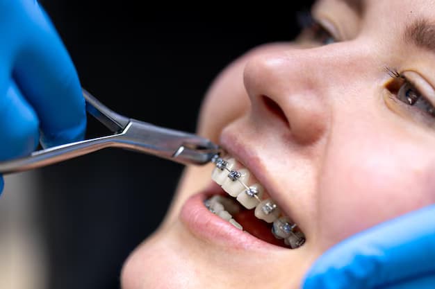 Straightforward Confidence: Guide to Traditional Metal Braces for a Smile Makeover