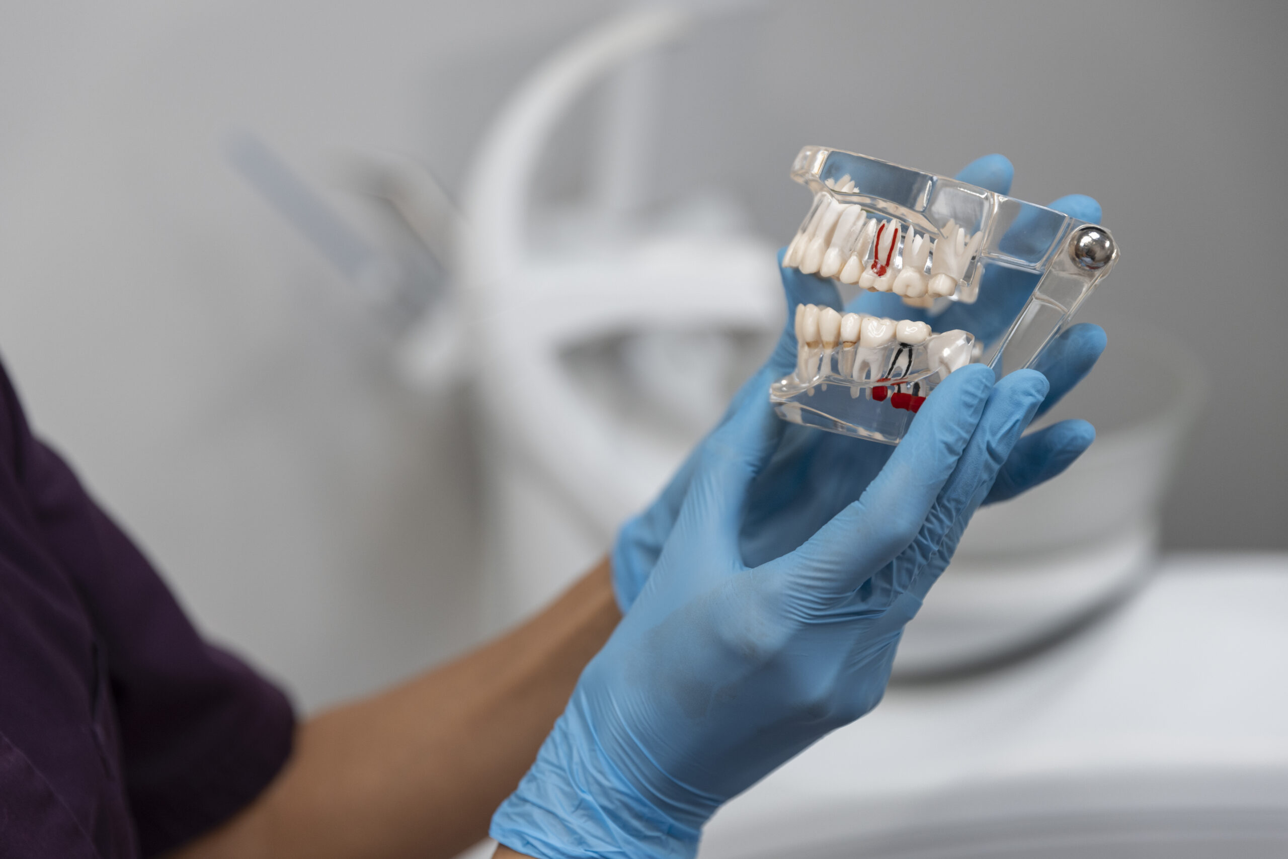 dental implants in Beverly Hills