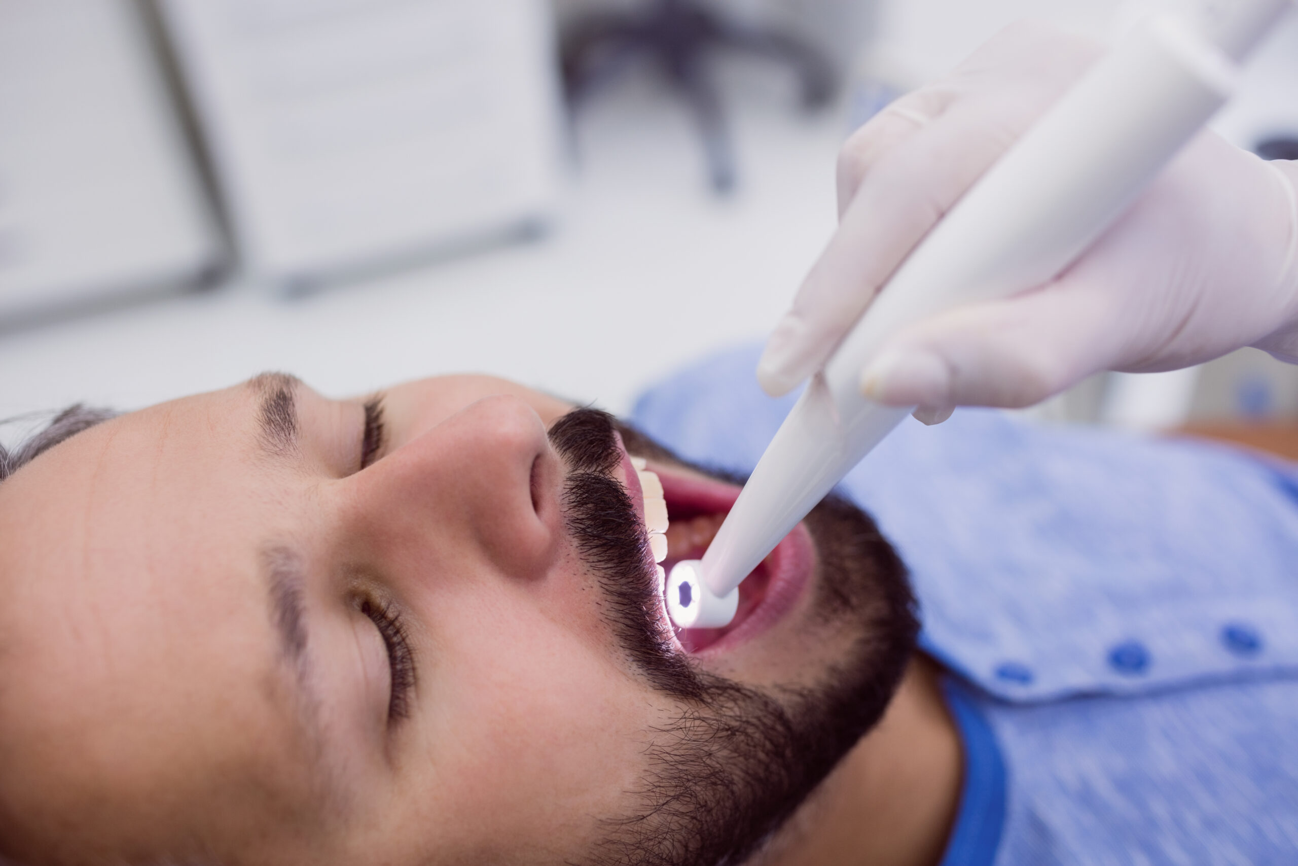dental fillings