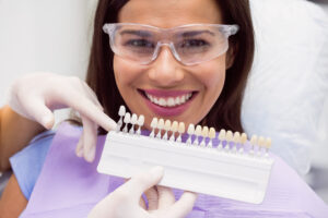 veneers