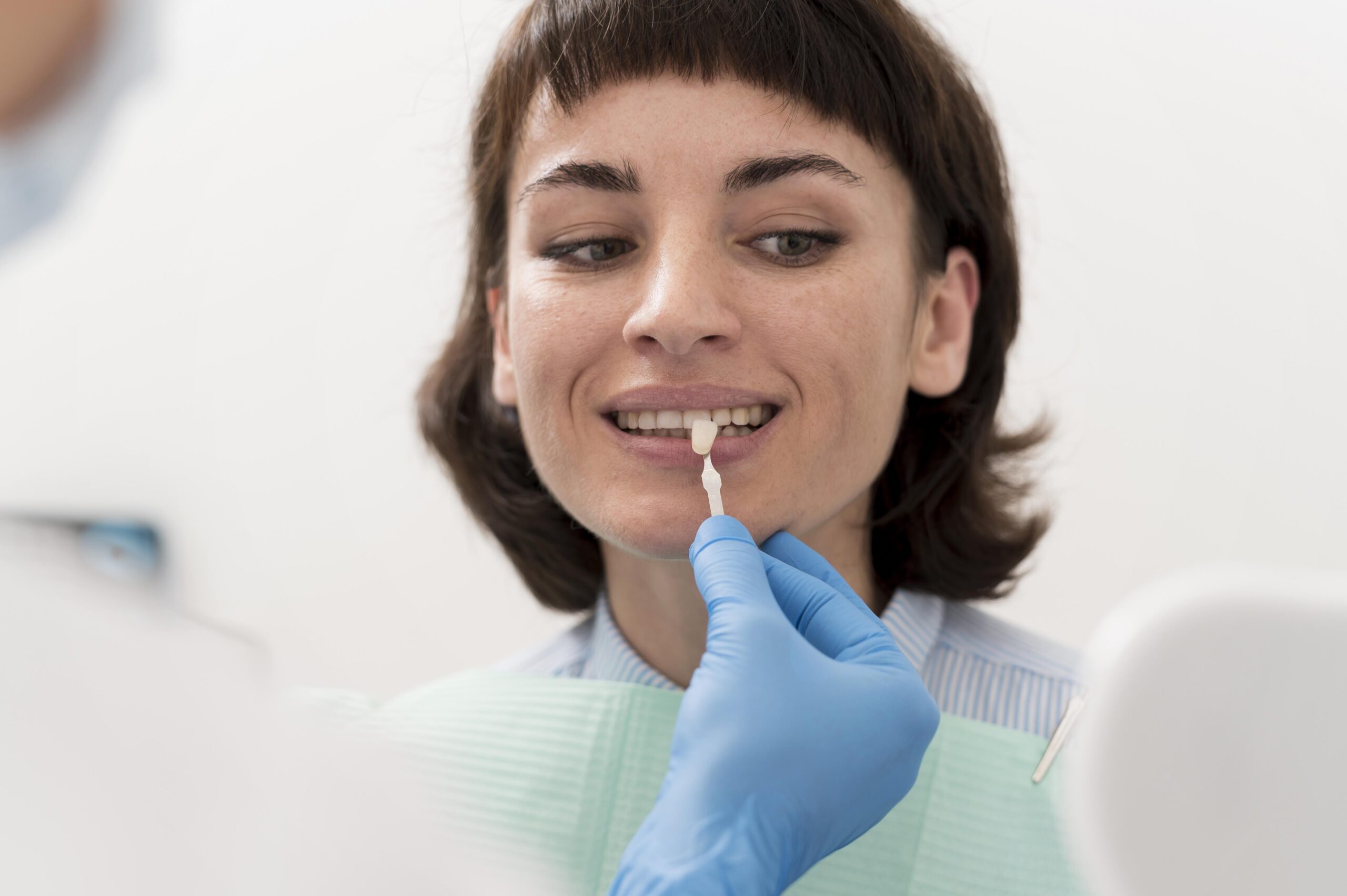 veneers