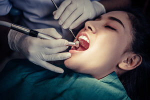 tooth extraction