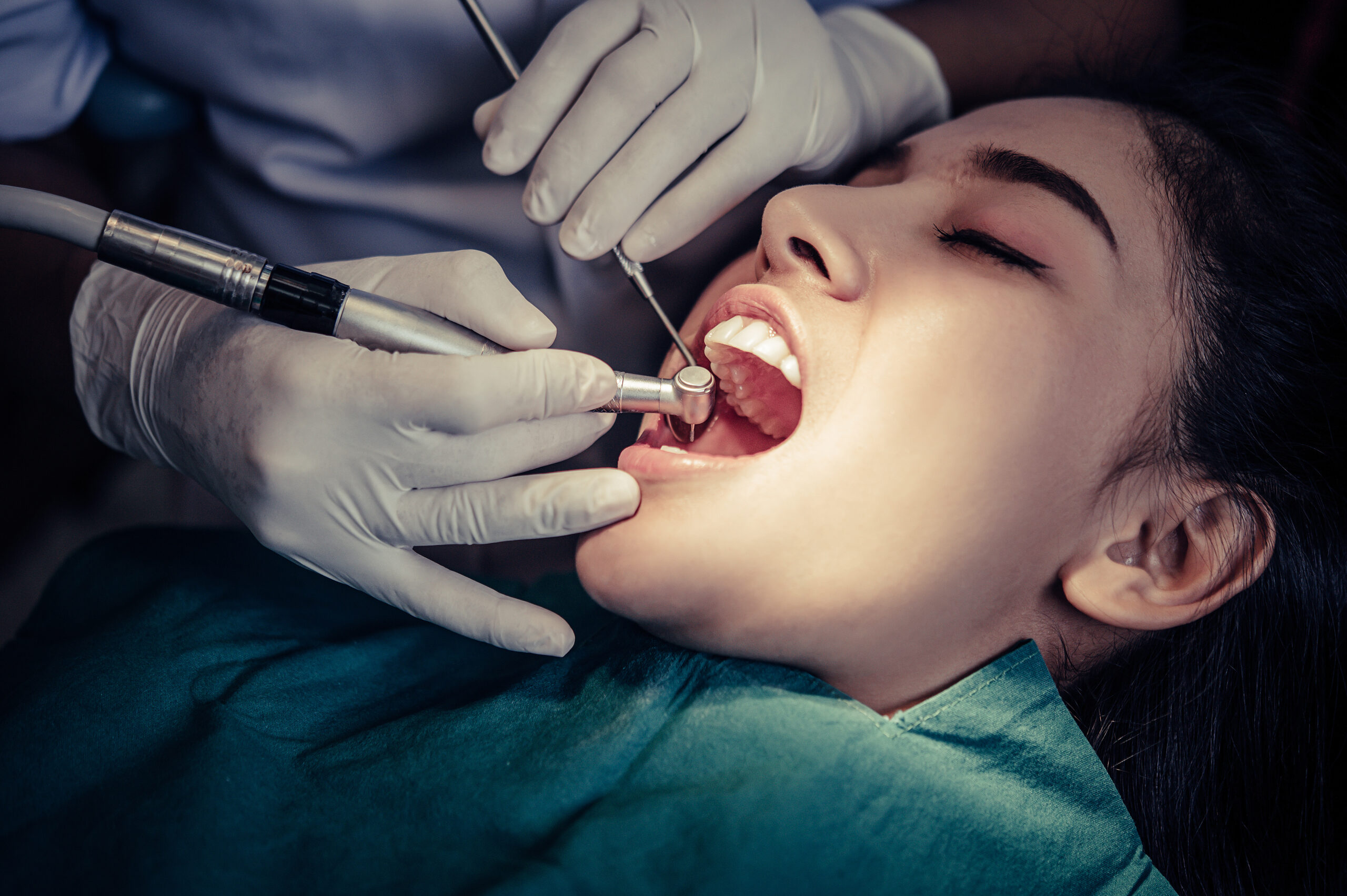 tooth extraction