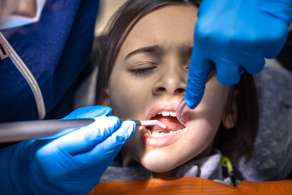 Cosmetic Dental Bonding