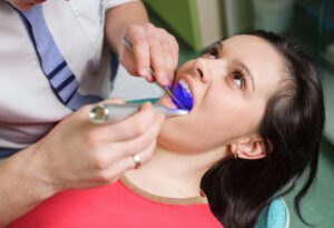 fluoride treatment beverly hills